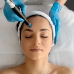 Unlocking Radiance: The Benefits of Professional Facials with In Skin